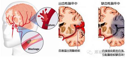 https://mmbiz.qlogo.cn/mmbiz_png/wt8gJp363qp4O7yl46gibyE2TTVa0qicHBtfoONlKbicxY9ZD7gob6lZAeJKRxHqlV2a8I2sGEzXuZL2ib8wFH5LxQ/0?wx_fmt=png